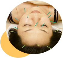 市ヶ谷オレンジ治療院 美容鍼 即効性を実感！新陳代謝を促進し肌のお悩みを改善！