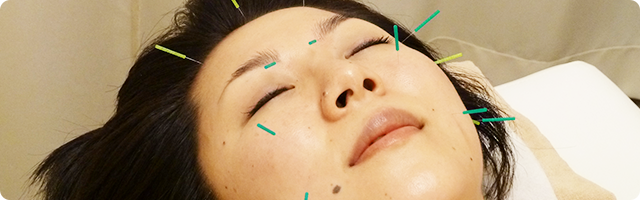 市ヶ谷オレンジ治療院 美容鍼 5.お顔のハリ